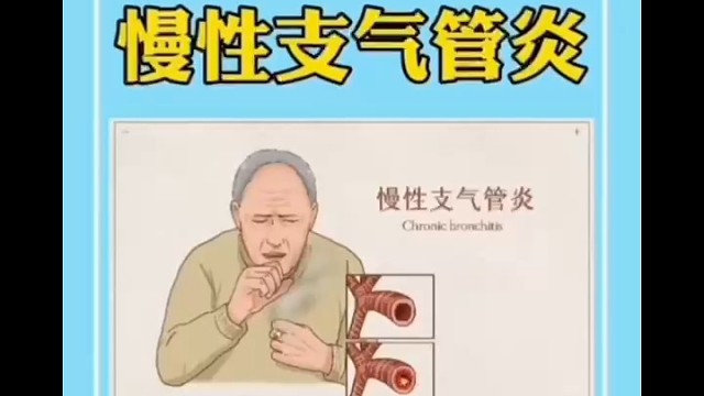 冬季如何预防慢性支气管炎