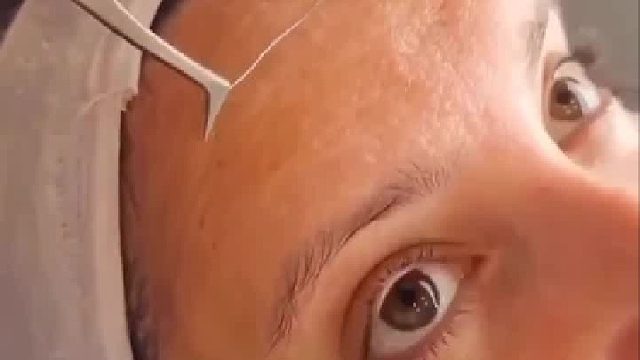 这是胶原蛋白吗？还有这种操作？