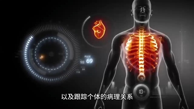 发作性睡病2