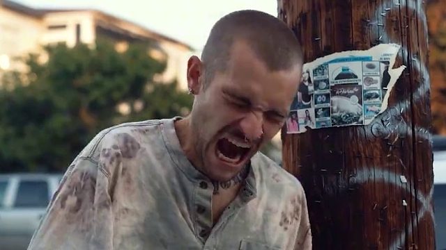 没看到伤口就不疼，这是什么原理，止痛药如何知道你哪里疼01