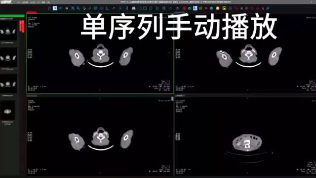 大家好 这是我们手动播放单序列图像