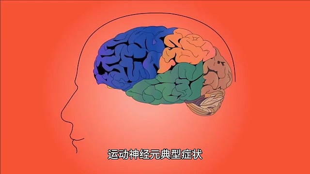 运动神经元病的诊断西医依赖于采集病史、体格检查、肌电图、验血、核磁共振、影像学检查、肌肉活检等，其中