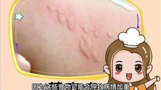 嘉兴治疗荨麻疹医院那家好