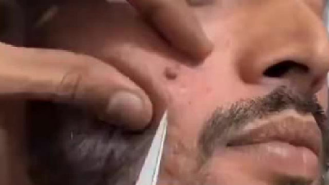 透过镜头都觉得狠疼