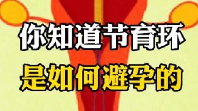 上环对女性到底有什么影响呢？