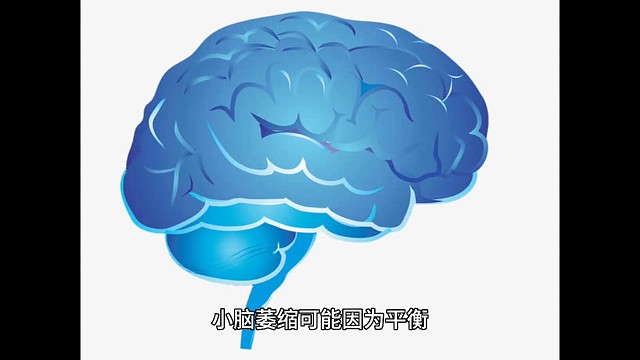 小脑萎缩避免长时间坐车或开车