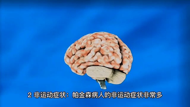 帕金森早发现早康复！