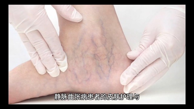 4状态愿天下更健康更长寿