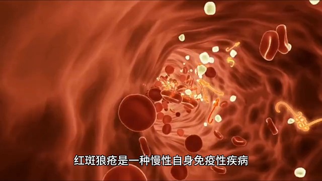 硬皮病可以根治吗这条视频讲解