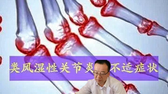 風(fēng)濕性關(guān)節(jié)炎