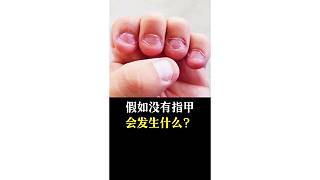 假如沒(méi)有指甲會(huì)發(fā)生什么？