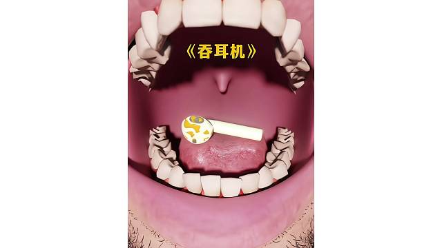 吞下了耳機(jī)應(yīng)該怎么辦？