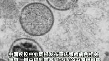 重庆猴痘病例病毒与德国病毒高度同源，系中国大陆首例输入性猴痘病例