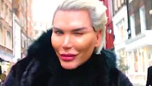 男人为了挽回爱情，决定加装四个腰子！