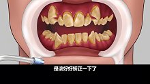 牙齿没有长好该怎么办，看完这个短片，请好好爱护自己的牙齿