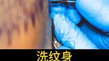 洗纹身对皮肤的伤害
#禁止向未成人提供纹身服务