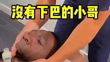 这位小哥看着很诡异，原来是没有下巴！