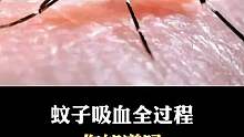 这是蚊子吸x全过程