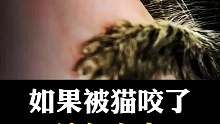 被猫咬了的后果会发生什么？？