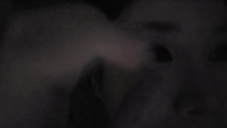 腳痛不適流露驚恐神態(tài)