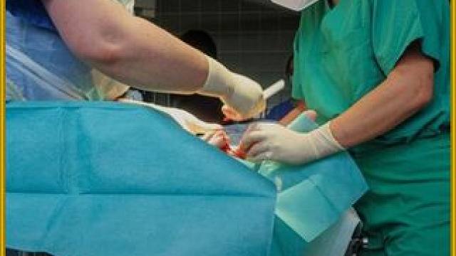 长年佩戴的戒指跟皮肉长在一起究竟能有多疼？ #奇葩  #戒指  #微创手术