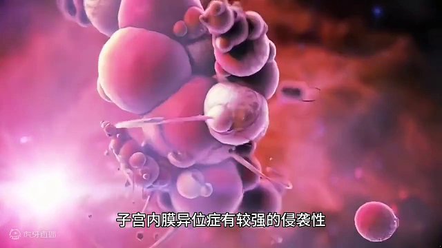 临汾仁爱生殖医院：子G内膜异位症的影响