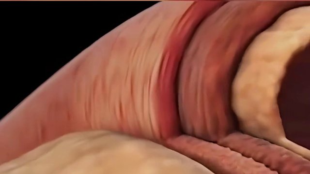 高血压如何形成的