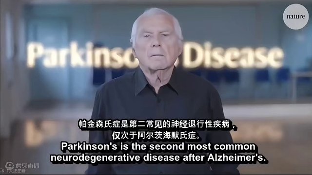 带你初步了解帕金森