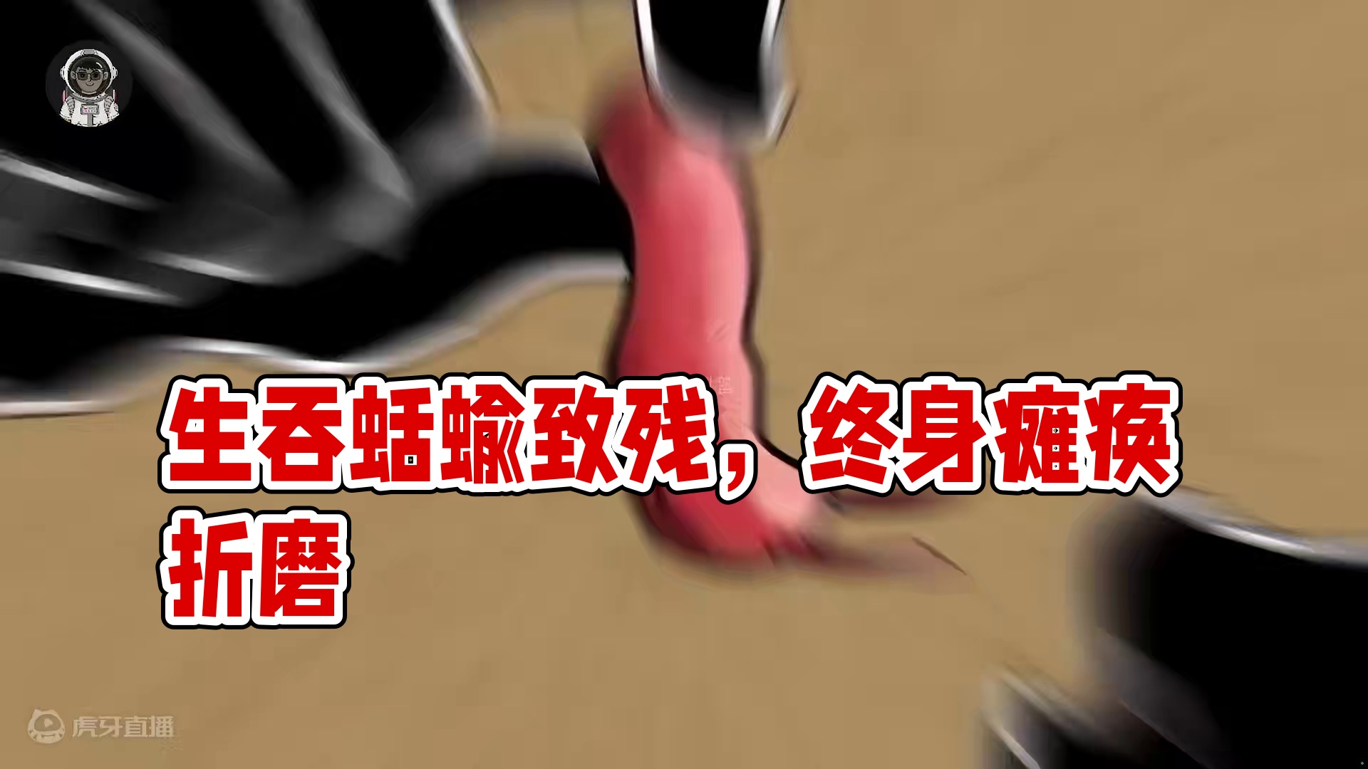 213. 只因生吞了一条蛞蝓，竟让小伙终身瘫痪受尽折磨。