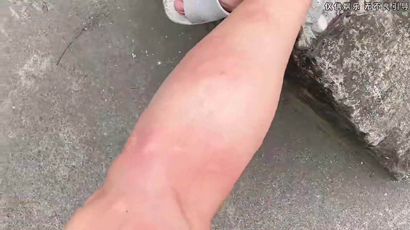 被蚊子惹急的人类到底能有多疯狂！