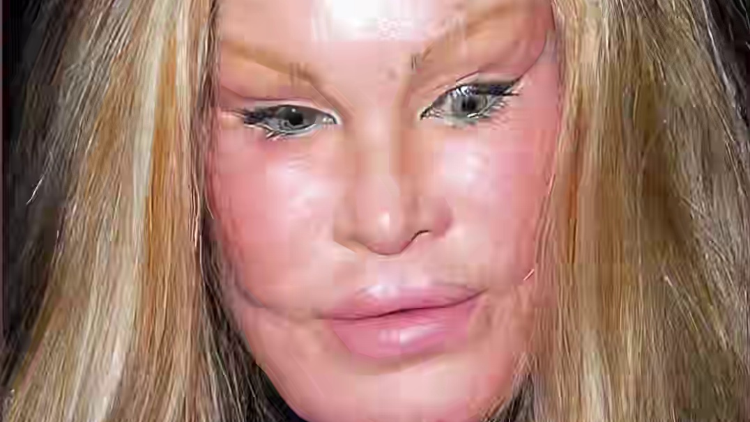 284. 为了变美！疯狂整形的三个女人，其中一个把自己变成了鬼！（2）