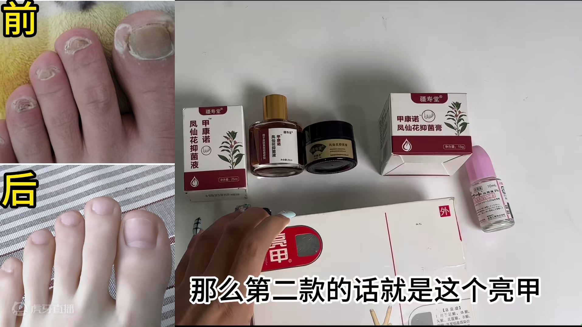 祛灰药物测评来袭！除菌修复不反灰！赶紧码住！