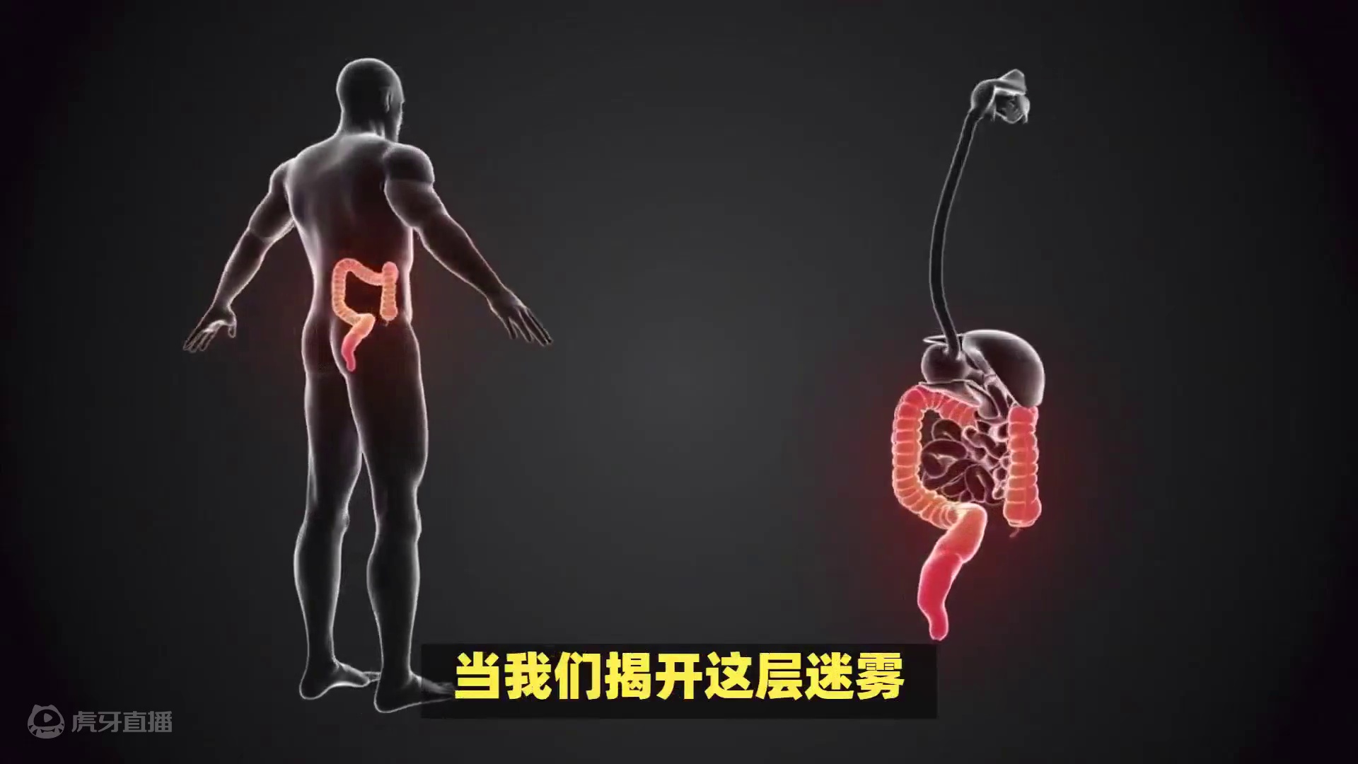 “给肠子洗洗澡”真的靠谱吗？