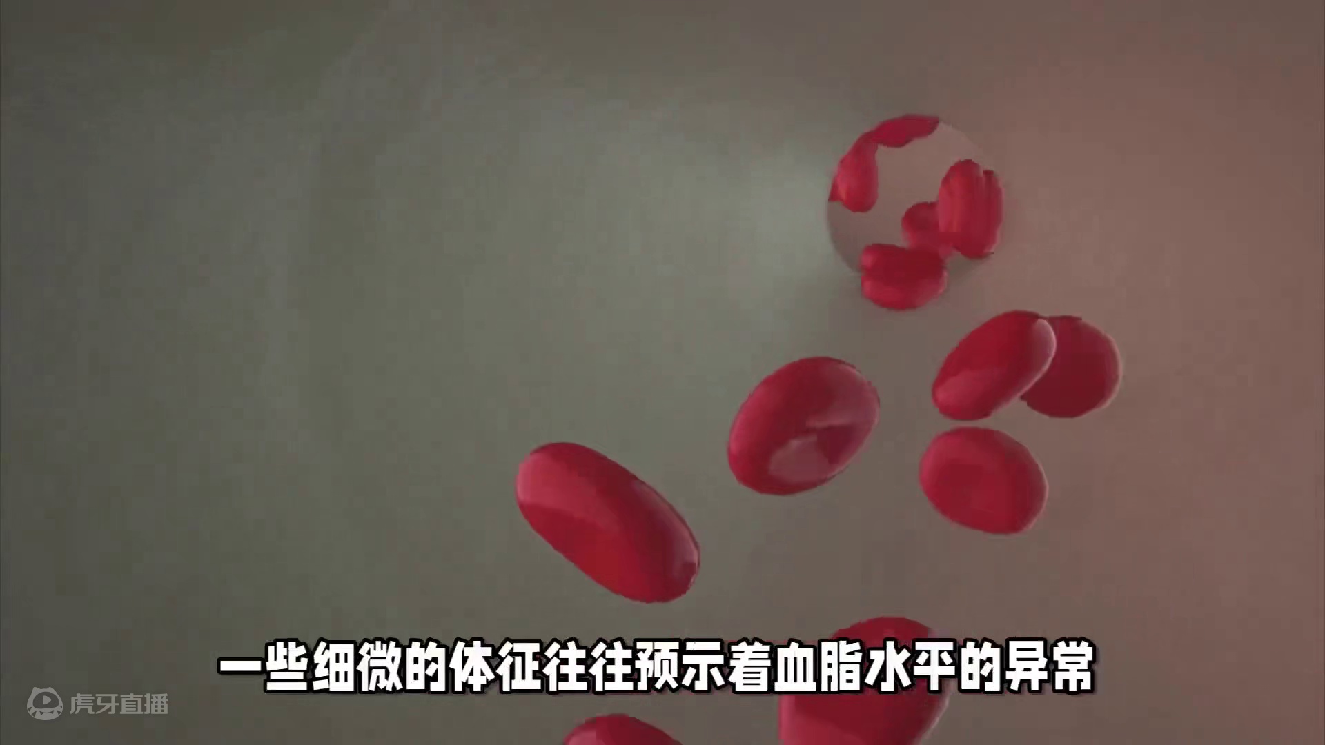 晨起注意，4个表现可能暗示血脂超标