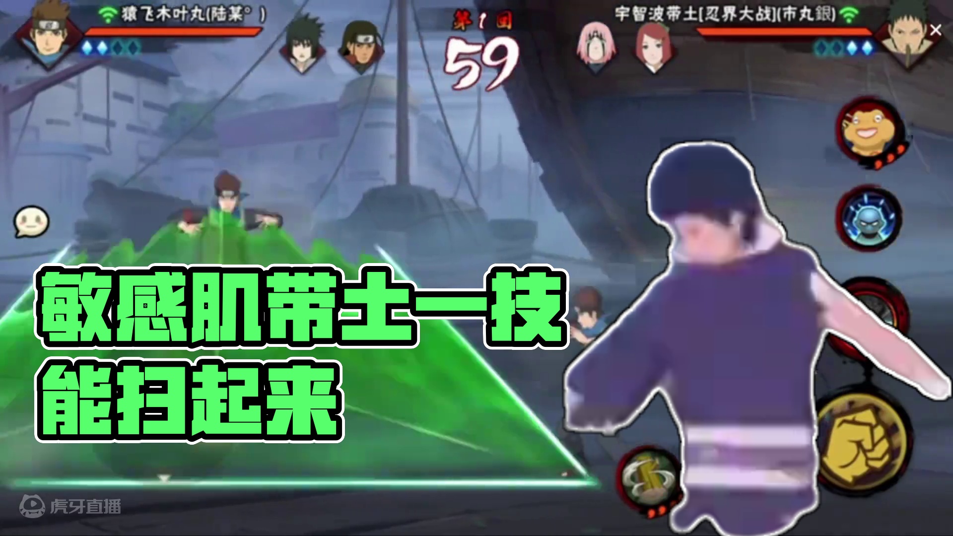 #火影忍者手游 敏感肌带土