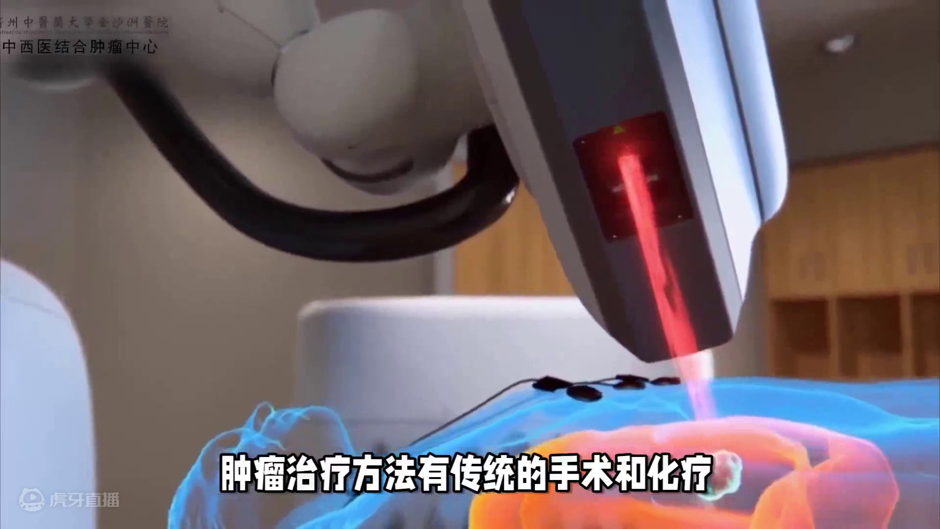 肺癌患者必看！70%需这种治疗，生存率提高，生存期延长！