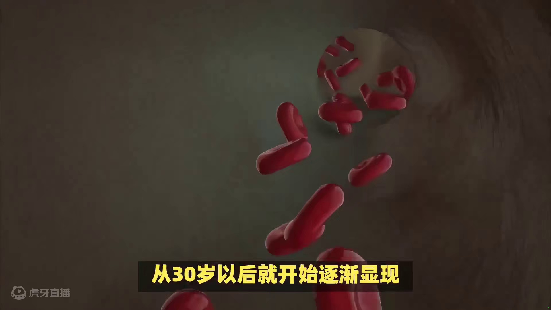 30岁就开始了！血管硬化有4个阶段，发现早或能逆转！