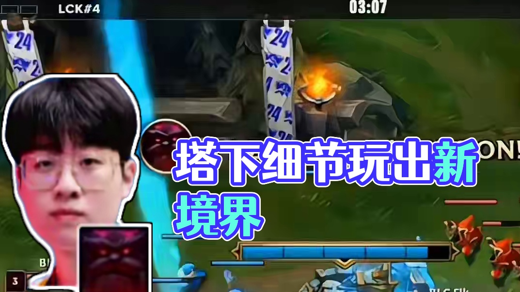 塔下细节的神# 英雄联盟