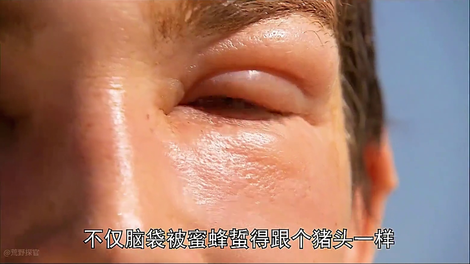 荒野求生贝爷 这期节目让贝爷受了大罪，被蜜蜂蛰的像个猪头，被臭鼬熏个半死，#荒野求生  #野外生存 