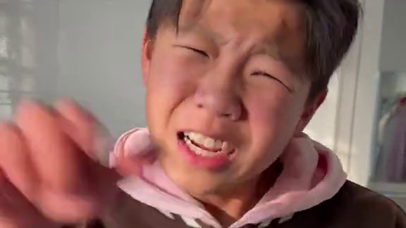 治痘只是你的谎言 #孙子逊 #搞笑