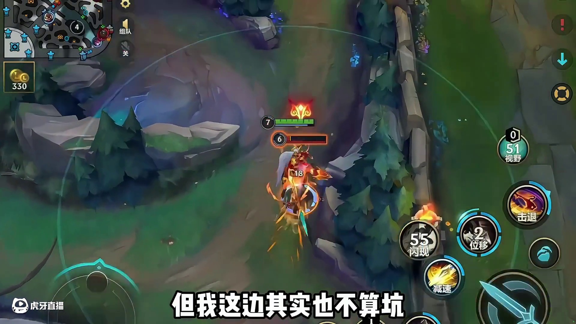 联盟手游上单分类！你是哪种？ #英雄联盟手游 #LOL手游班德尔峡谷来咯