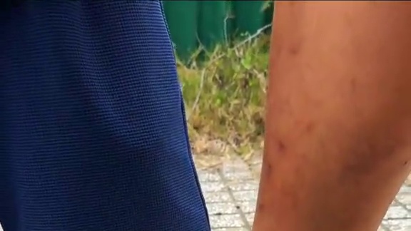 ToRung搞笑 踩小哥的脚
#搞笑#解压#搞笑视频