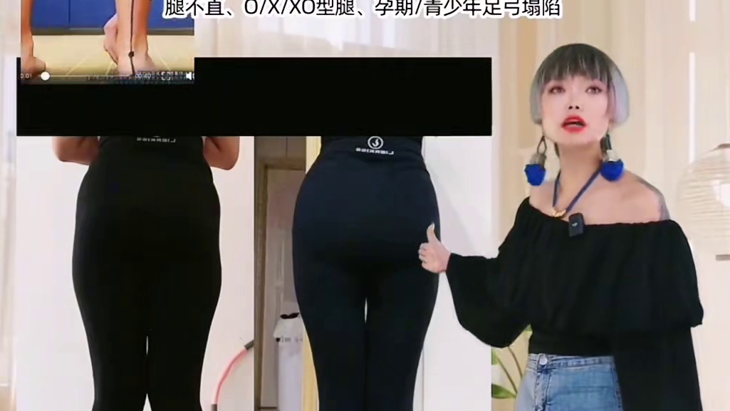 告别罗圈腿#直腿神器 #足弓塌陷 #告别罗圈腿