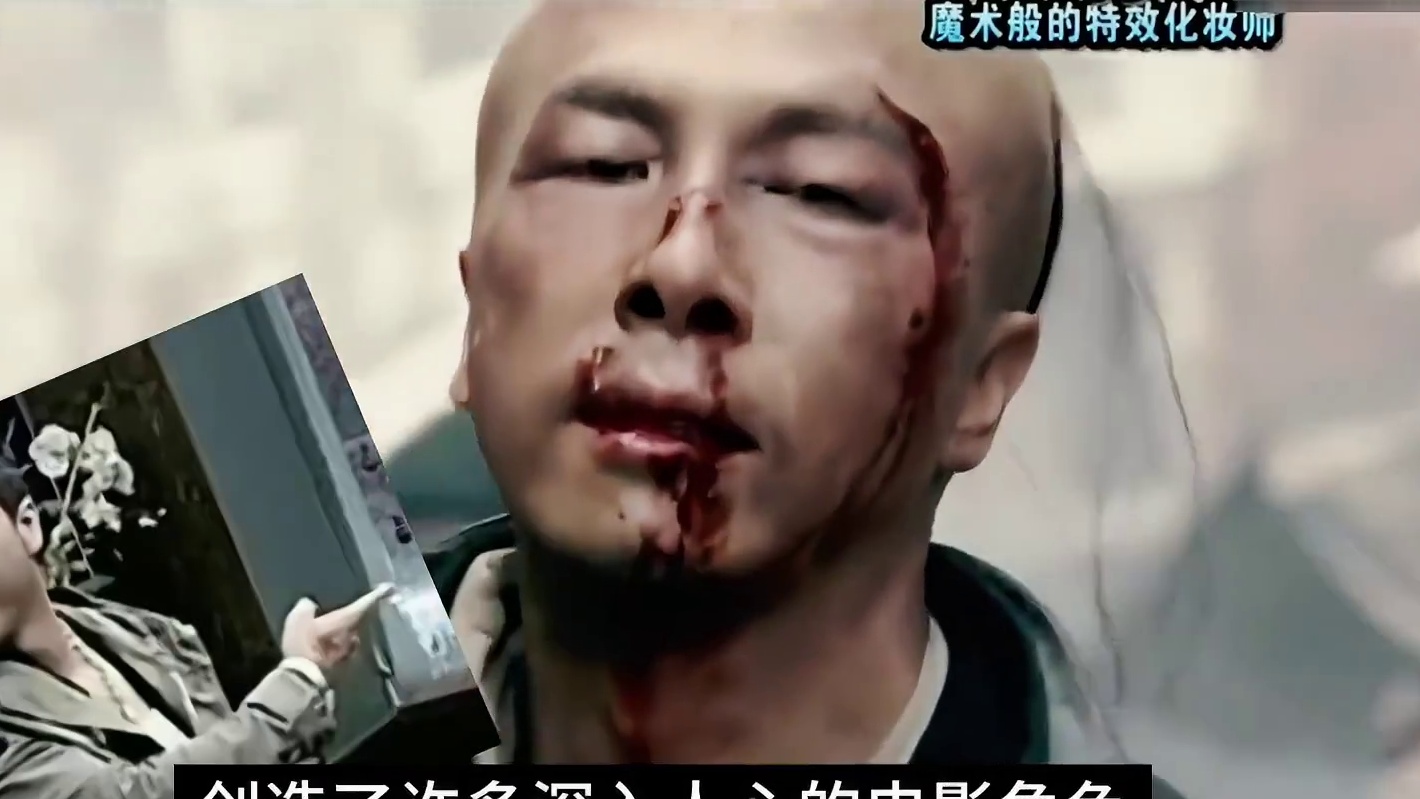 在脸上化上暴打妆容去医院看病 (1)