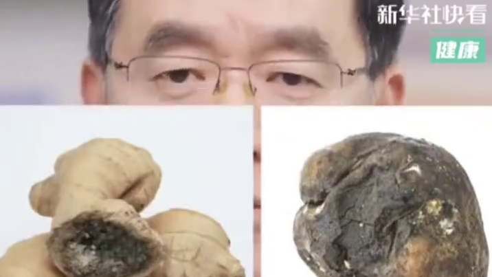 你的胃怕这5个点！胃肠科医生：占的越多，胃越差！转给你身边中了的人！