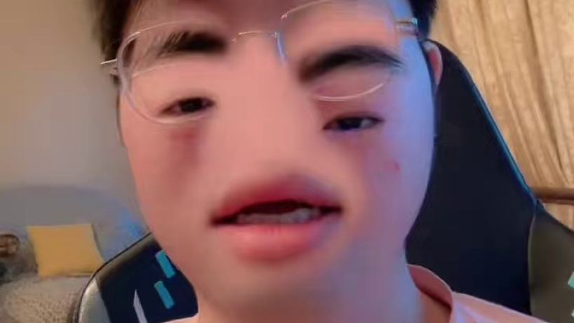 誒？我鼻子呢??！#zz1tai姿態(tài) #搞笑