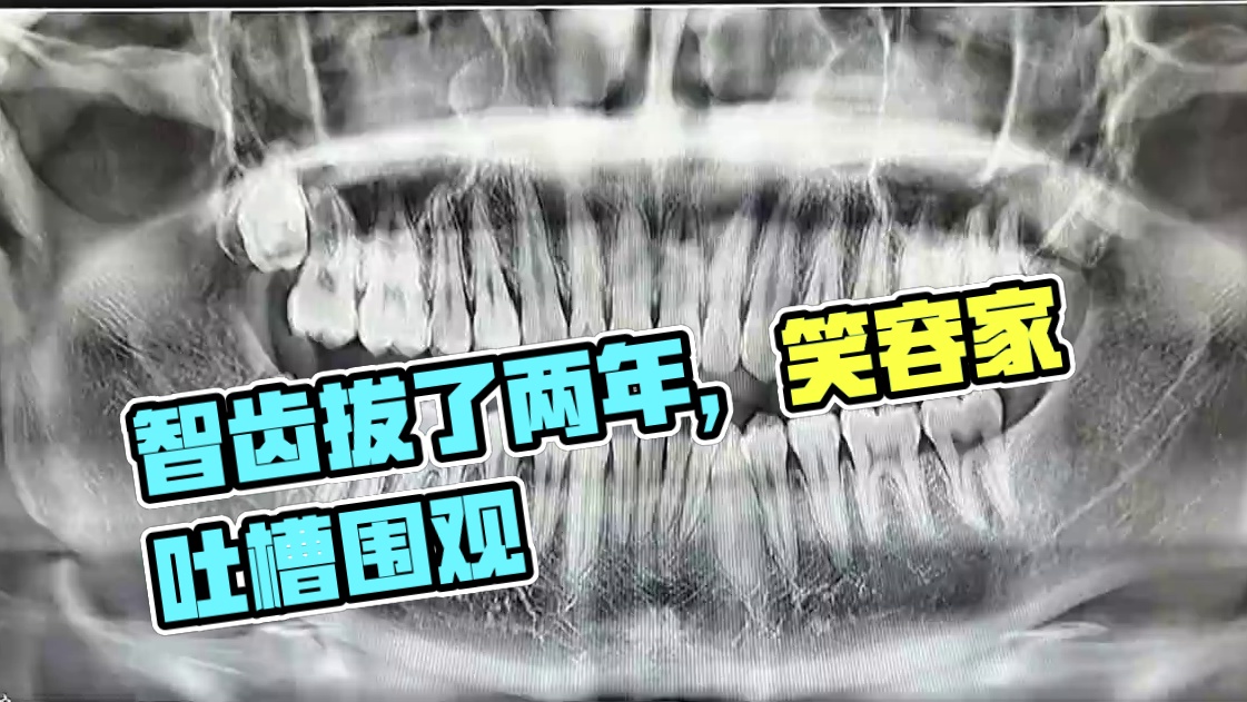 我发布了一个新视频，快来围观吧！