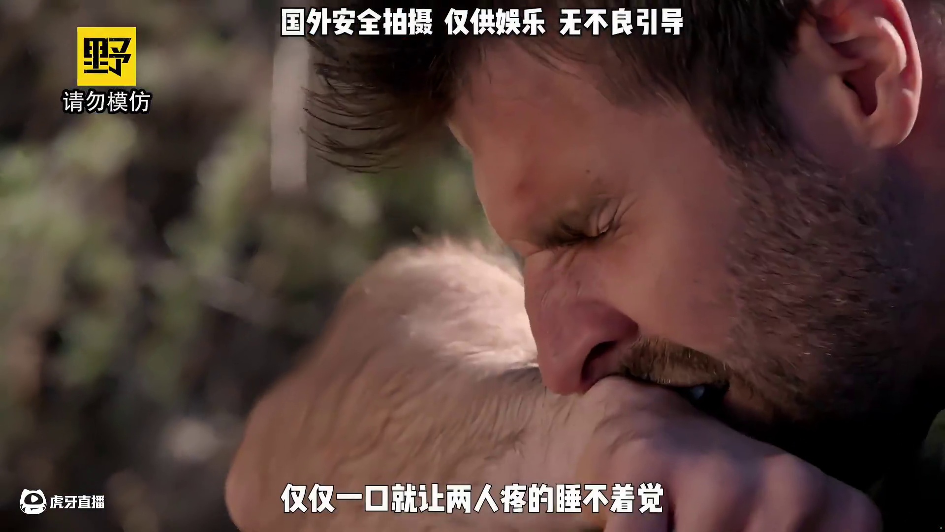 被黑寡妇蜘蛛咬一口会有多疼？ #整活 #老外真会玩