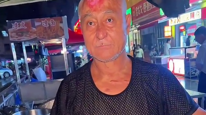 深圳街头烧伤大爷卖臭豆腐，致敬每一个努力生活的人！