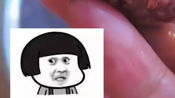 海葵吃过吗？ #海葵